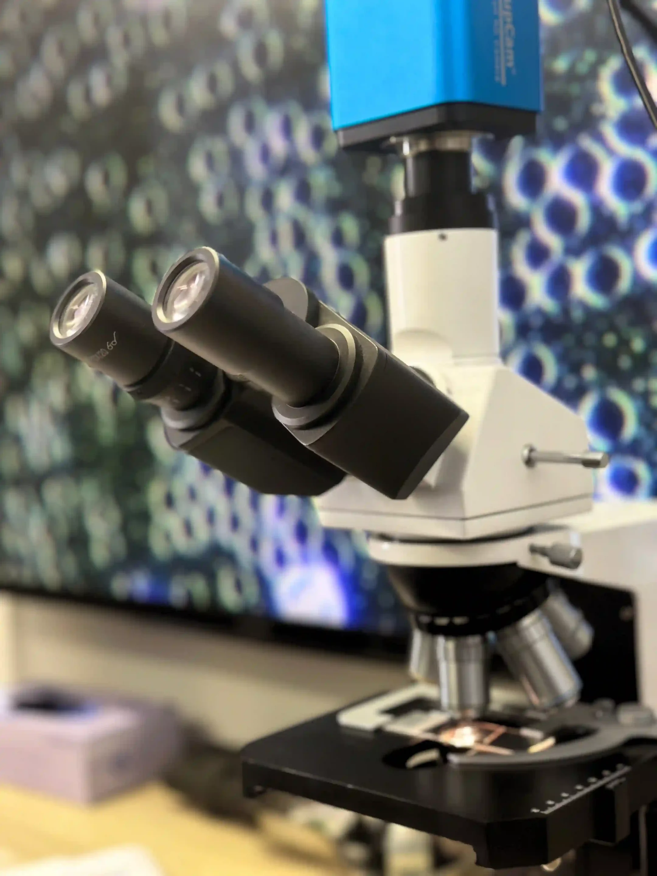 Live Blood Analysis microscopy at Exodus Immunology Cape Town